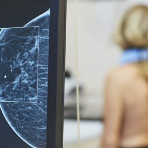 Mammacentrum sv. Agáty - snímok mammografu